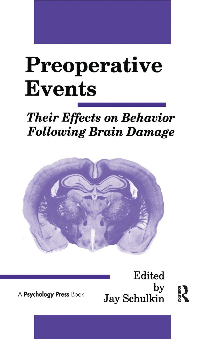 Jay Schulkin - Preoperative Events, Inbunden