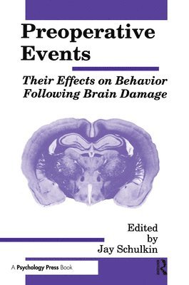 Jay Schulkin - Preoperative Events, Häftad