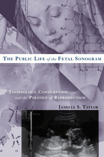 Janelle S. Taylor - Public Life of the Fetal Sonogram, Häftad