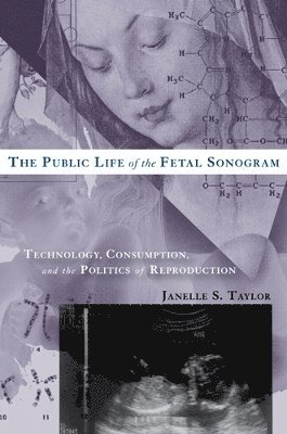 The Public Life of the Fetal Sonogram 1