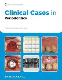 bokomslag Clinical Cases in Periodontics