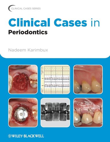 bokomslag Clinical Cases in Periodontics