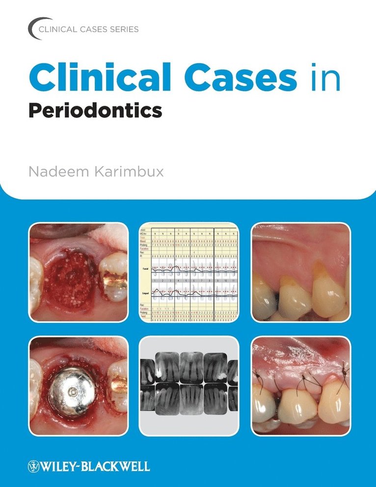 Karimbux, Nadeem Karimbux - Clinical Cases in Periodontics, Häftad