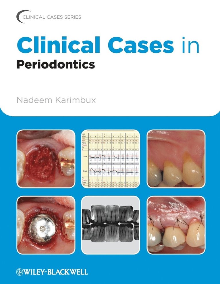 Clinical Cases in Periodontics 1