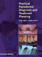 bokomslag Practical Periodontal Diagnosis and Treatment Planning