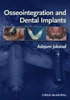 bokomslag Osseointegration and Dental Implants