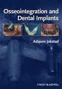 Osseointegration and Dental Implants 1