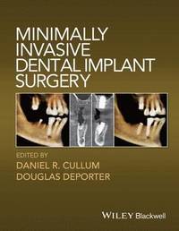 bokomslag Minimally Invasive Dental Implant Surgery