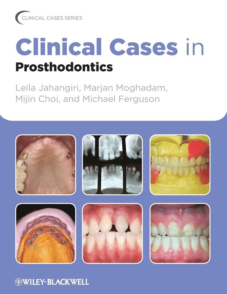 Clinical Cases in Prosthodontics 1