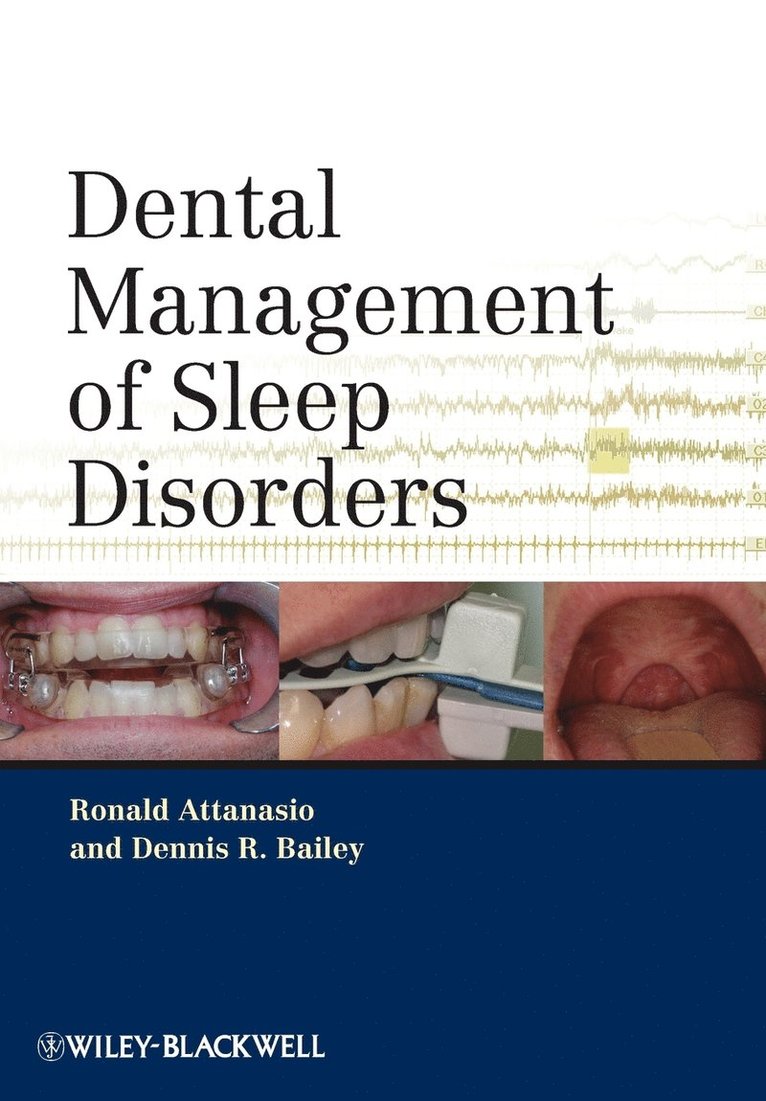 Dental Management of Sleep Disorders 1