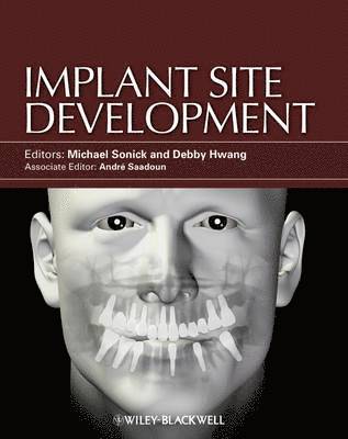 bokomslag Implant Site Development