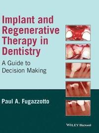 bokomslag Implant and Regenerative Therapy in Dentistry