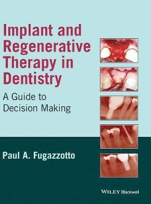 Paul A. Fugazzotto, Massachusetts) Fugazzotto, Paul A. (Private Practice, Milton, Paul A Fugazzotto - Implant and Regenerative Therapy in Dentistry, Inbunden
