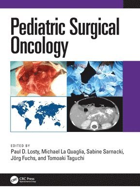 bokomslag Pediatric Surgical Oncology