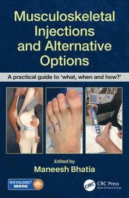 Musculoskeletal Injections and Alternative Options 1