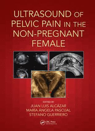 bokomslag Ultrasound of Pelvic Pain in the Non-Pregnant Patient