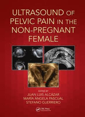 Juan Luis Alcázar, María Ángela Pascual, Stefano Guerriero, Spain) Alcazar, Juan Luis (University of Navarra, Pamplona, Spain) Pascual, Maria Angela (Hospital Universitari Dexeus, Barcelona, Italy) Guerriero, Stefano (University of Cagliari - Ultrasound of Pelvic Pain in the Non-Pregnant Patient, Häftad