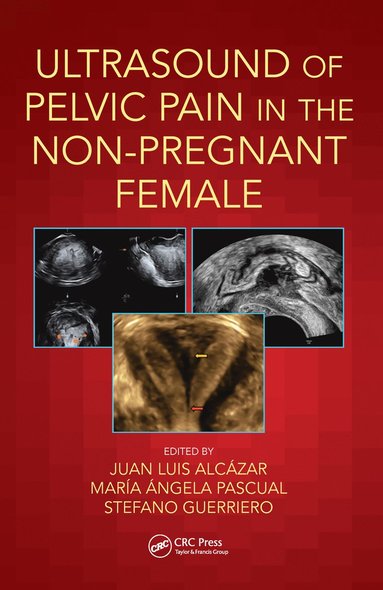 bokomslag Ultrasound of Pelvic Pain in the Non-Pregnant Patient