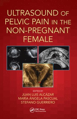 Ultrasound of Pelvic Pain in the Non-Pregnant Patient 1