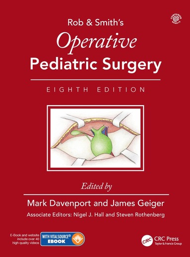 bokomslag Operative Pediatric Surgery