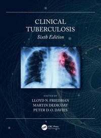 bokomslag Clinical Tuberculosis