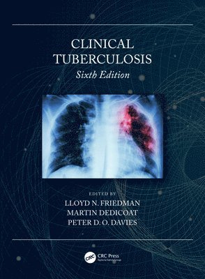 Clinical Tuberculosis 1
