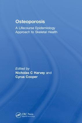 bokomslag Osteoporosis
