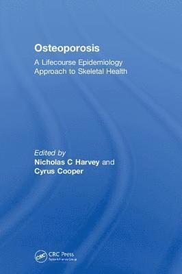 Osteoporosis 1