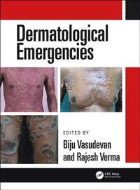 bokomslag Dermatological Emergencies