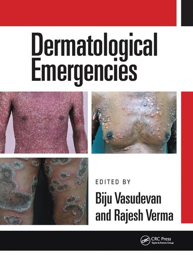 bokomslag Dermatological Emergencies