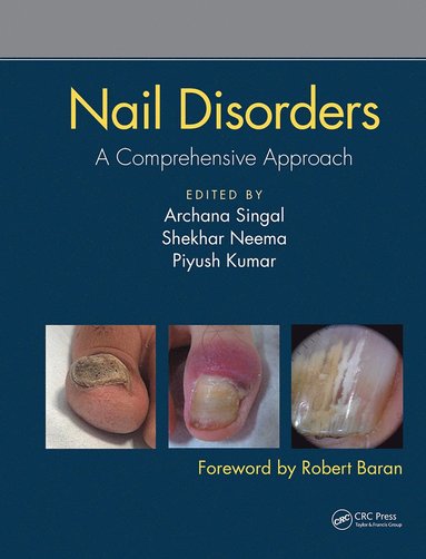 bokomslag Nail Disorders