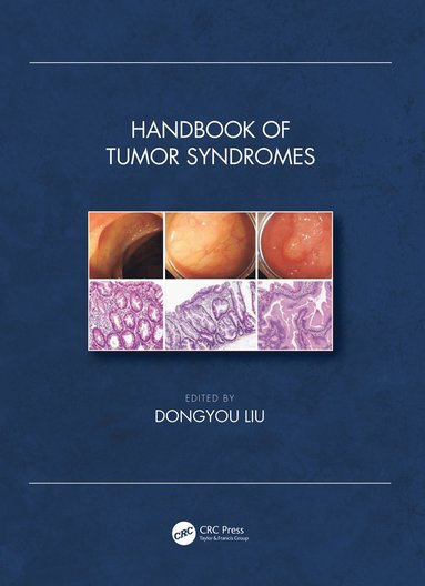 bokomslag Handbook of Tumor Syndromes