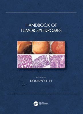 Handbook of Tumor Syndromes 1