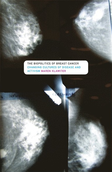 bokomslag Biopolitics of Breast Cancer