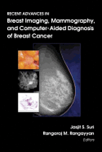 bokomslag Recent Advances in Breast Imaging, Mammography, and Computer-aided Diagnosis of Breast Cancer