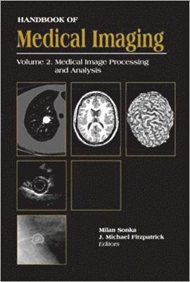 Handbook Of Medical Imaging, Volume 2