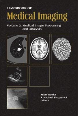 Handbook Of Medical Imaging, Volume 2 1