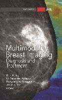 E. Y. K. Ng - Multimodality Breast Imaging, Inbunden
