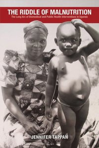bokomslag Riddle of Malnutrition