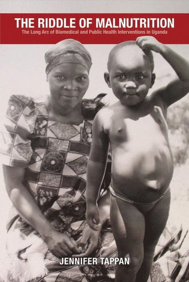 bokomslag Riddle of Malnutrition