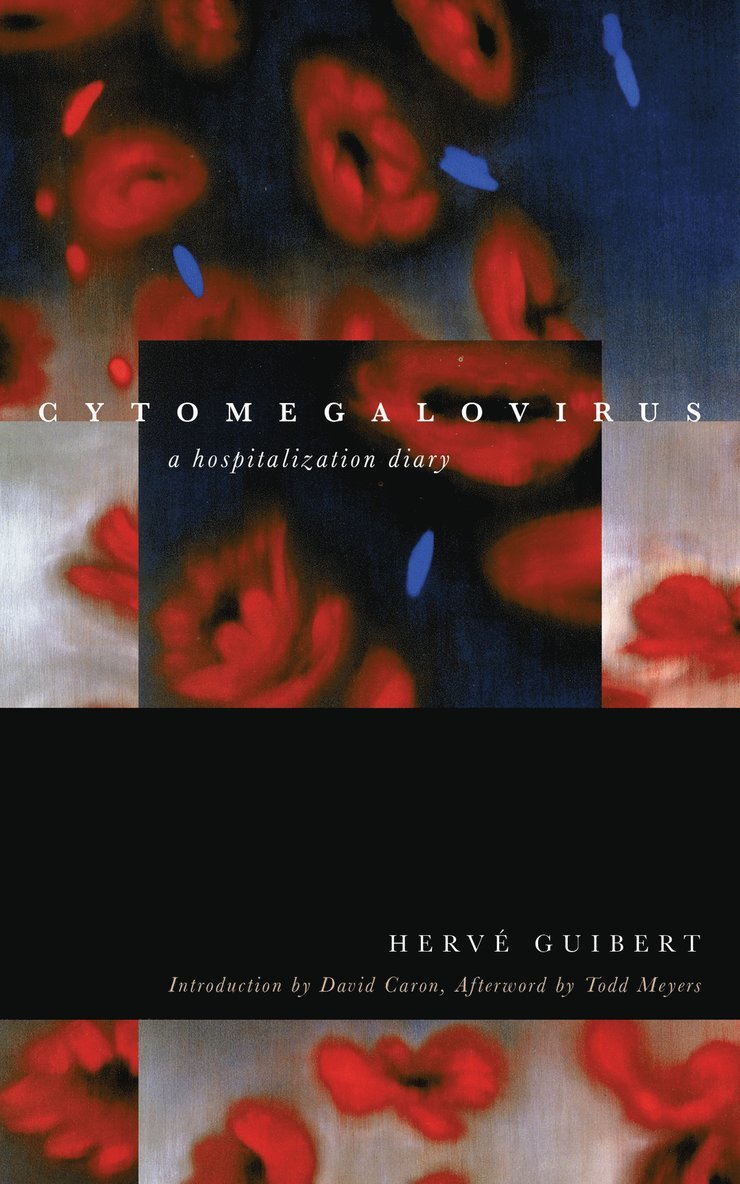 Hervé Guibert, Herve Guibert - Cytomegalovirus, Inbunden