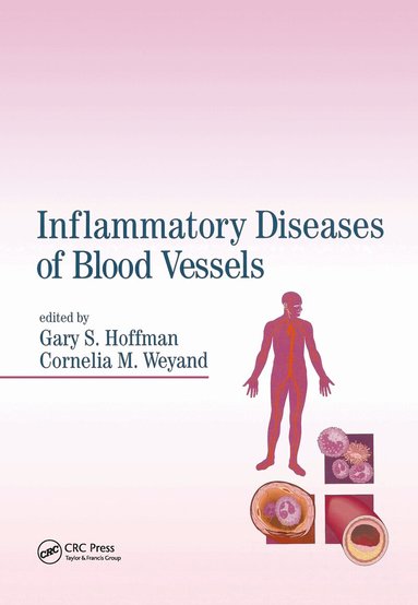 Gary S. Hoffman, Cornelia M. Weyand - Inflammatory Diseases of Blood Vessels, Inbunden
