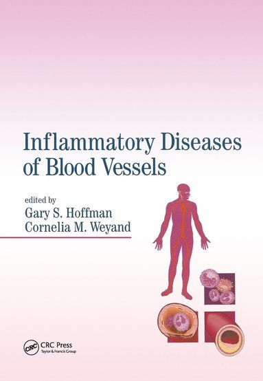 bokomslag Inflammatory Diseases of Blood Vessels