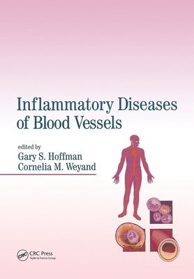 Inflammatory Diseases of Blood Vessels 1