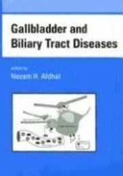 bokomslag Gallbladder and Biliary Tract Diseases