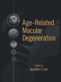 bokomslag Age-Related MacUlar Degeneration