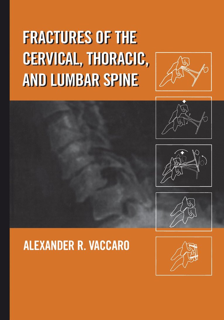 Alexander R. Vaccaro - Fractures of the Cervical, Thoracic, and Lumbar Spine, Inbunden