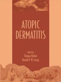 bokomslag Atopic Dermatitis