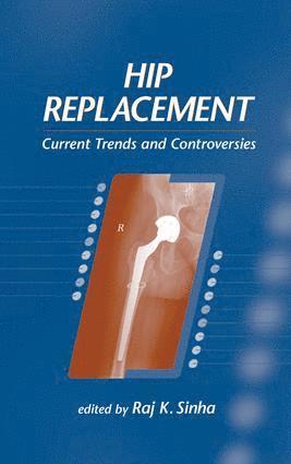 Raj K. Sinha - Hip Replacement, Inbunden