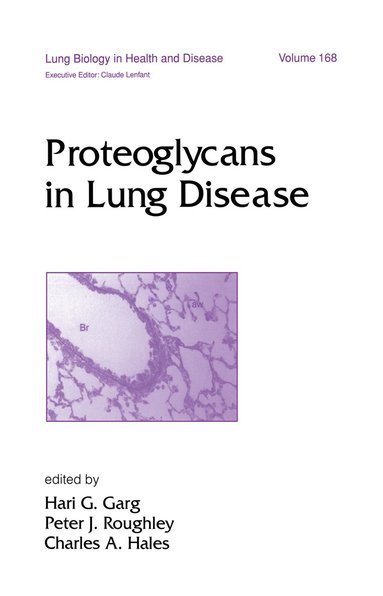 bokomslag Proteoglycans in Lung Disease